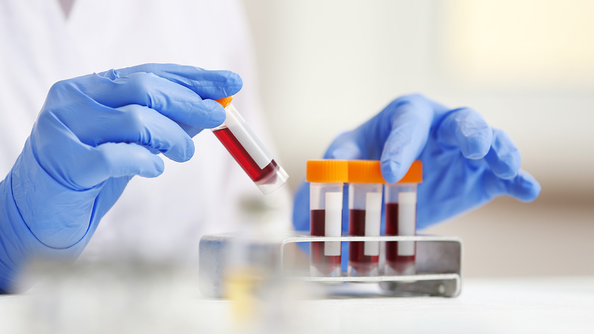 14---What-is-Liquid-Biopsy.jpg